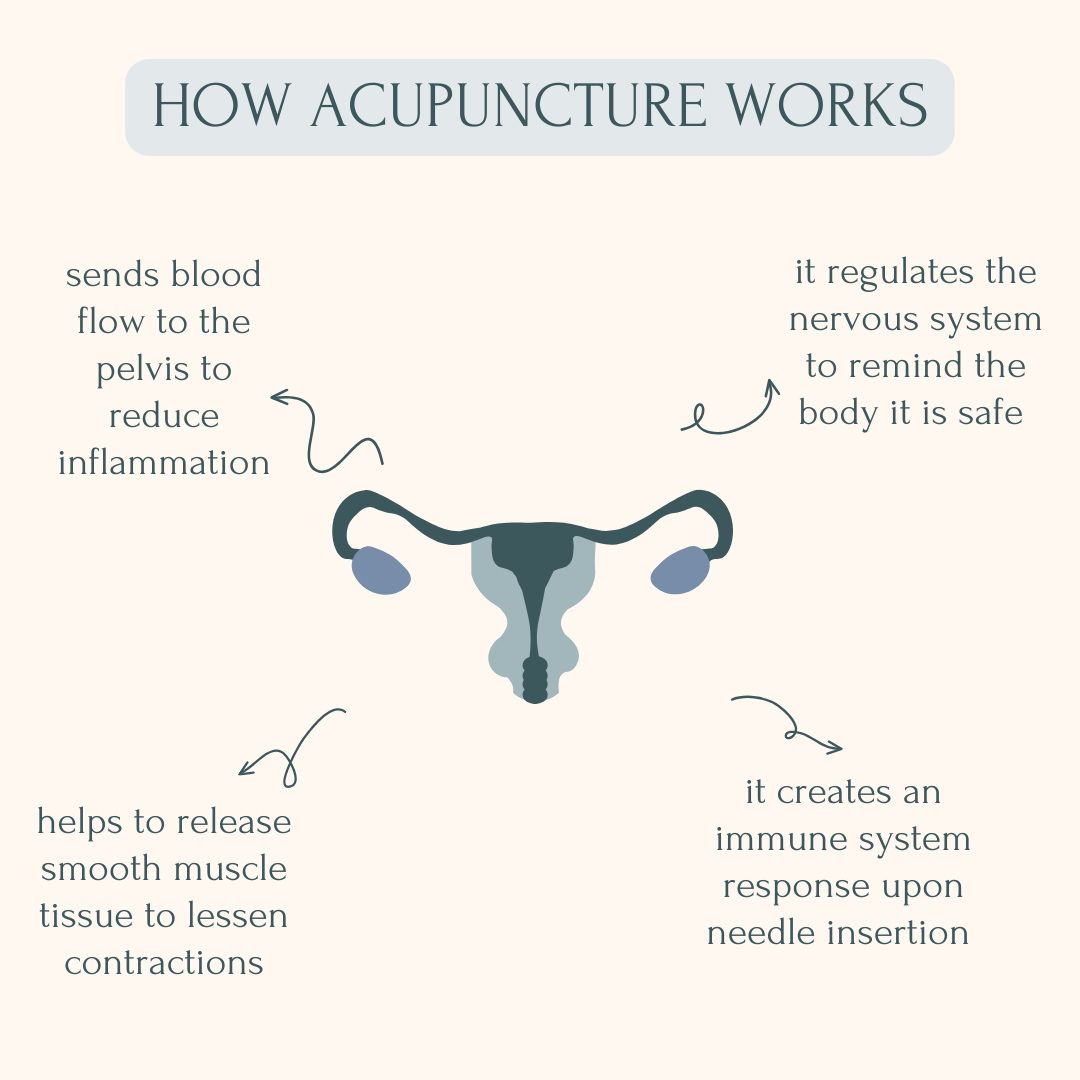 Acupuncture for PCOS and endometriosis 